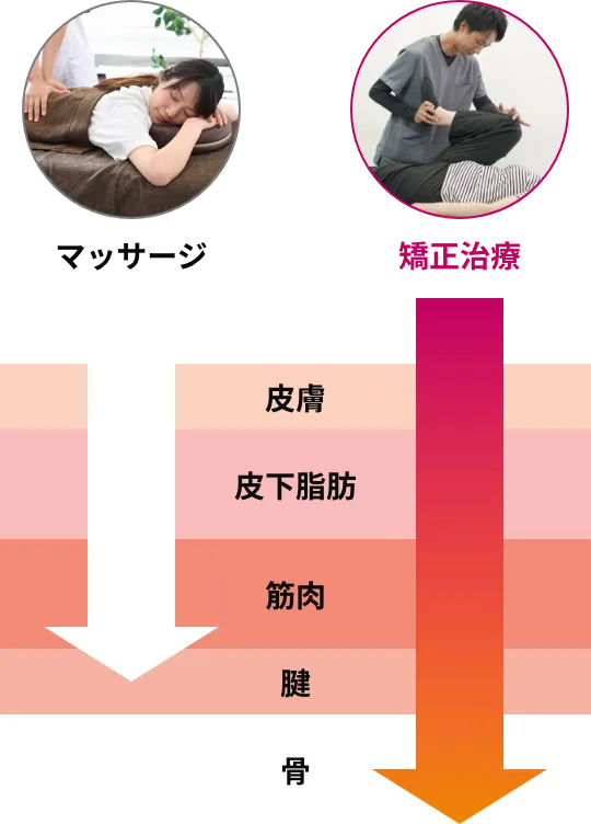 矯正治療
