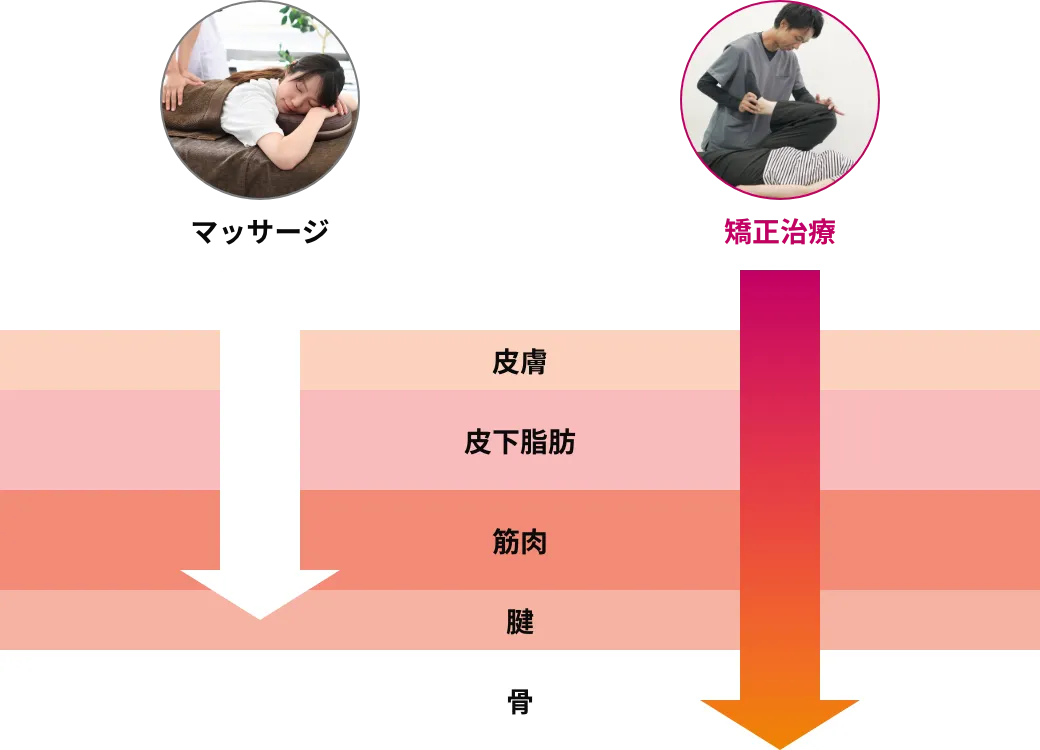 矯正治療